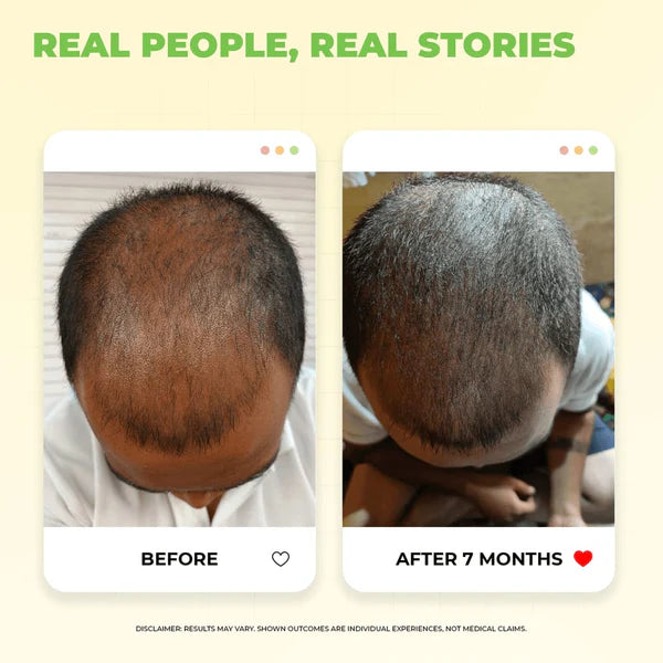 Ronaq-e-Zulf Hair Oil | Reduces Hair Fall | Promotes Hair Growth