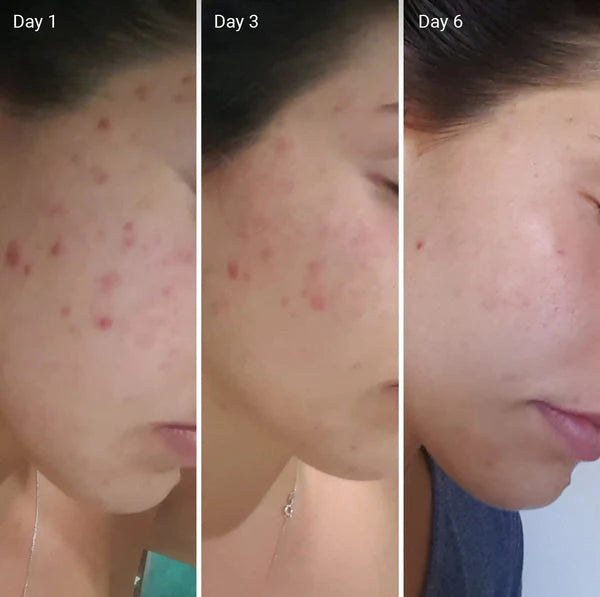 Face Cream + Face Wash By MF Products